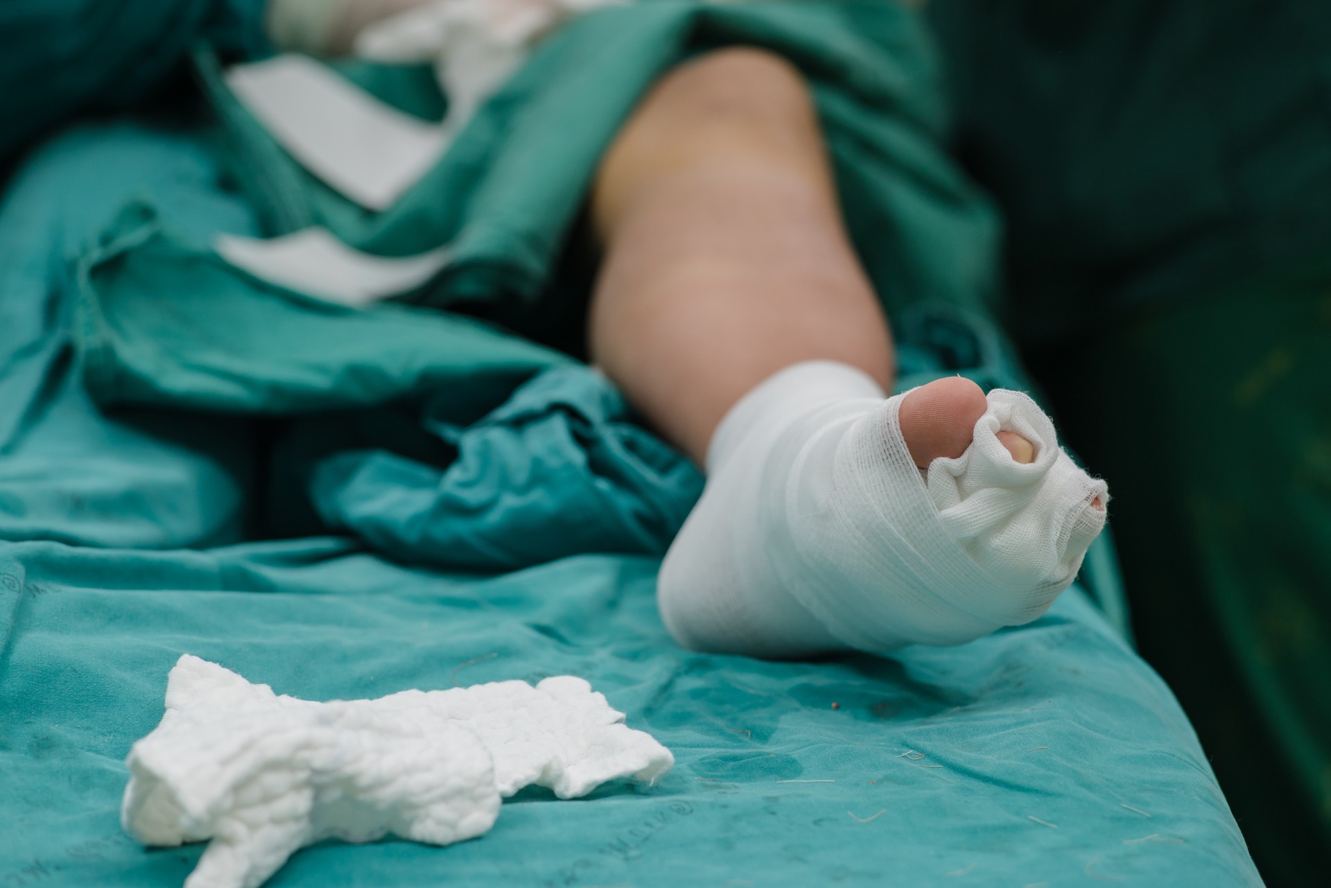 Patient's feet with bandage in the hospital.